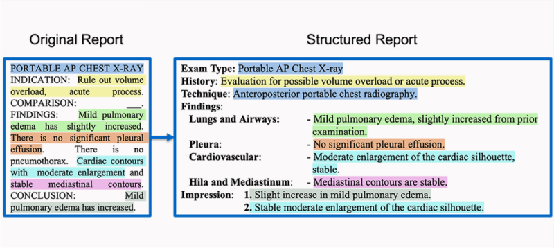 Chest Xray Reports